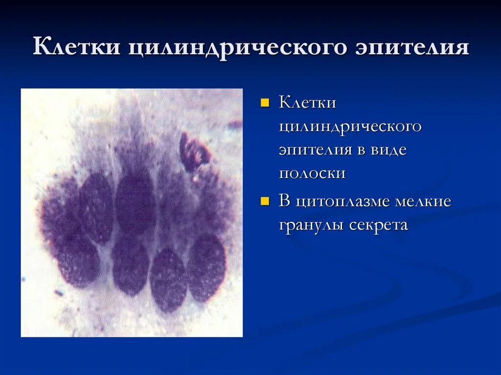 Клетки метаплазированного эпителия с реактивными изменениями. Цилиндрический эпителий шейки матки цитология. Реснитчатый цилиндрический эпителий цитология. Атипичные клетки цилиндрического эпителия. Клетки плоского и цилиндрического эпителия.