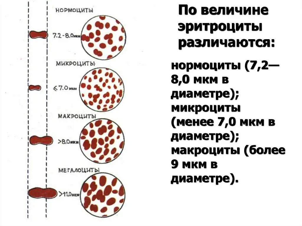 Сколько хромосом содержит эритроцит собаки. Нормоциты. Эритроциты нормоциты. Нормоциты микроциты макроциты мегалоциты. Нормоцит эритроцит.