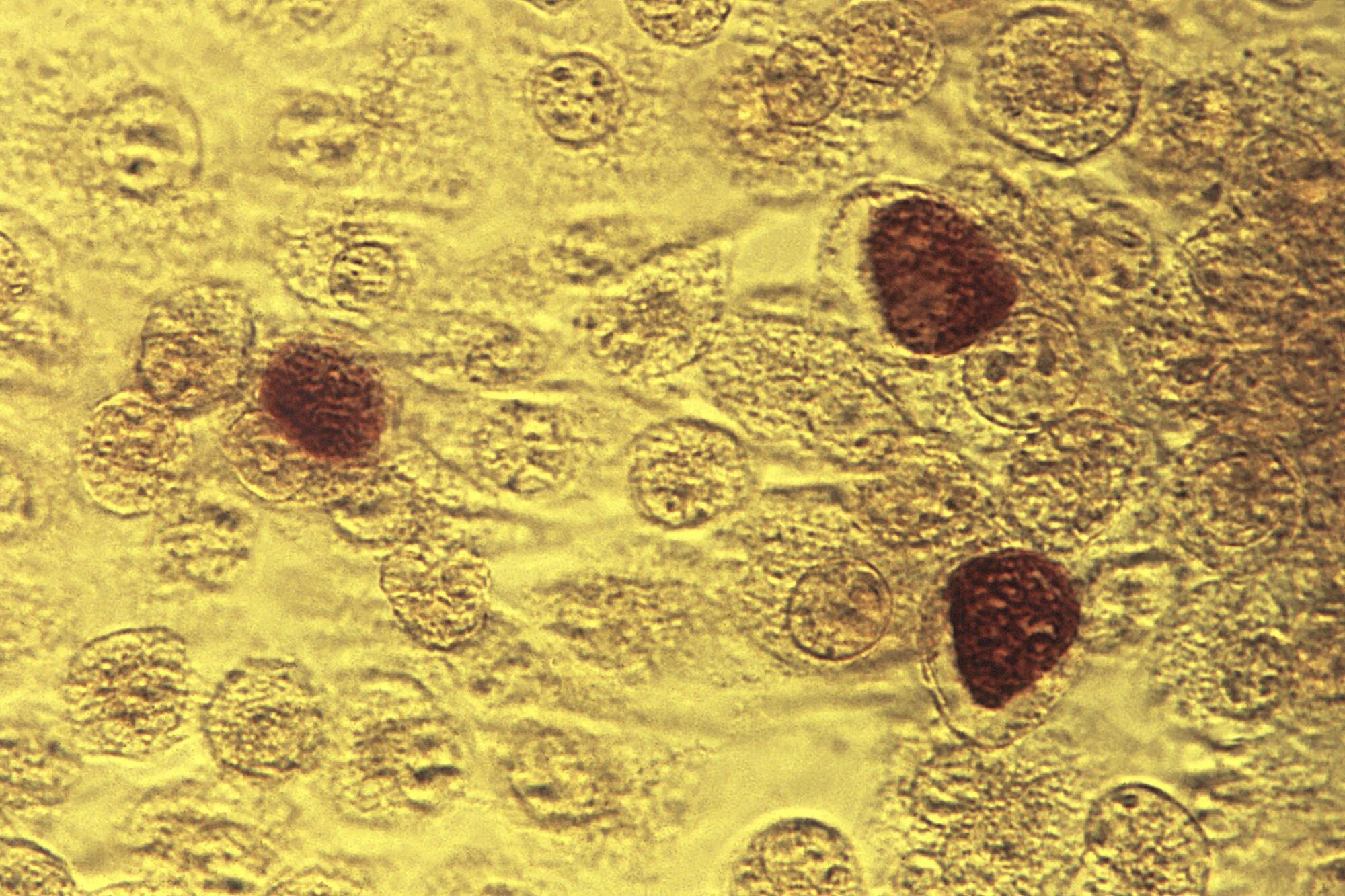 Chlamydia trachomatis. Хламидии возбудитель орнитоза\. Хламидии под микроскопом.