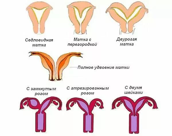 Матку девочка рассказ