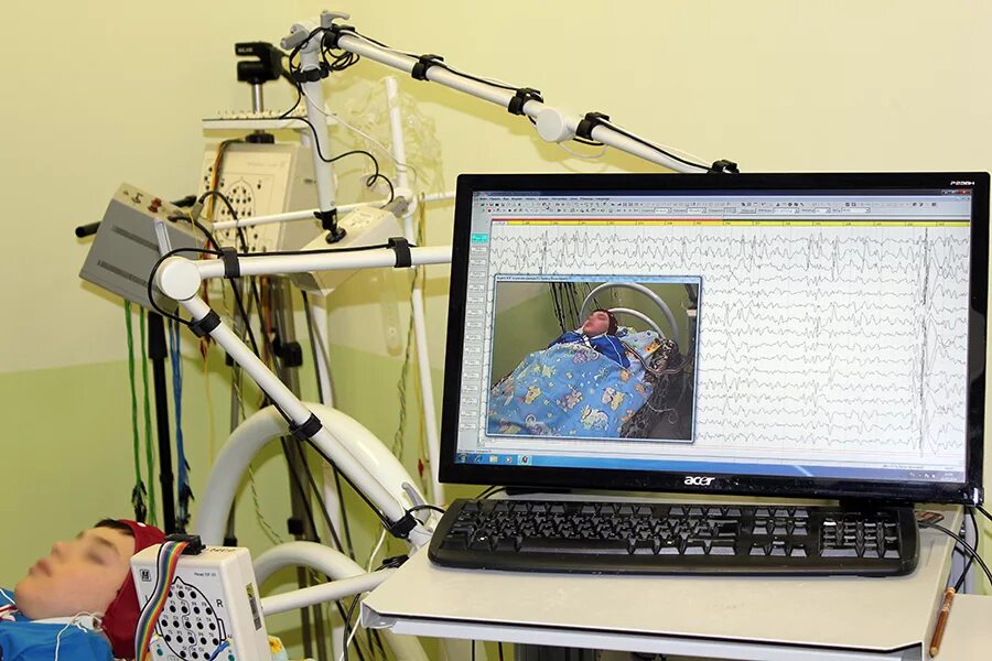 Сделать ээг мониторинг. Сделать ээг мониторинг. Ээг видеомониторинг дневного сна. Суточнлое мониторинг ээг. Сделать ээг мониторинг.