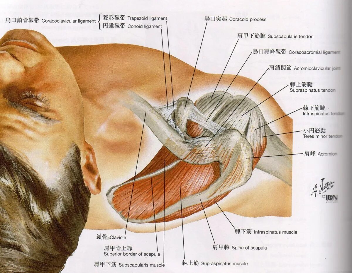 Ротаторная манжета плечевого сустава. Повреждение ротаторная манжета. Ротаторная манжета плечевого сустава анатомия. Сухожилия надостной мышцы плечевого.