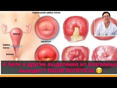 Ничего Не Чувствую При Вагинальном Сексе