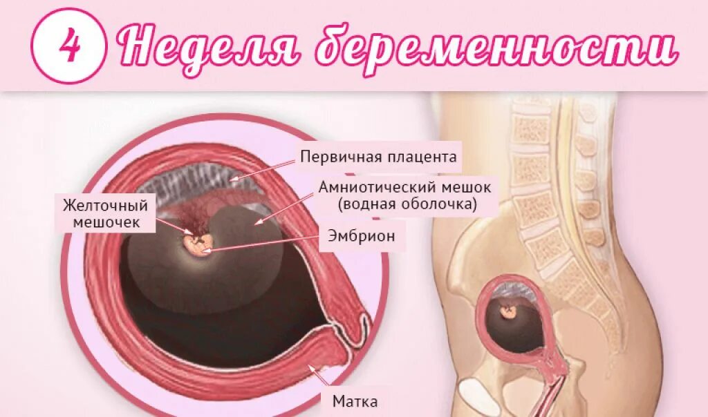 Беременность 3 недели что делать. Плод на 4 неделе беременности. Эмбрион на 4 неделе беременности.