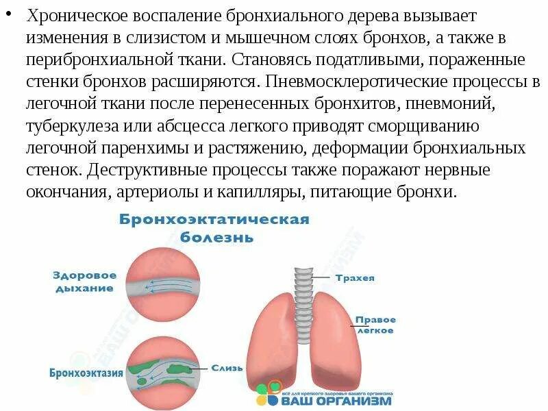 Бронхиальное раздражение