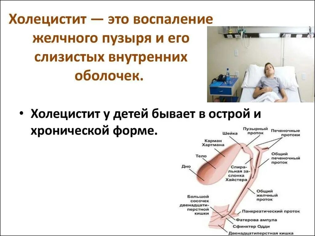 Острый холецистит у детей симптомы. Воспалительные заболевания желчного пузыря. Признаки острого холецистита у детей. Холецистит воспаление желчного пузыря.