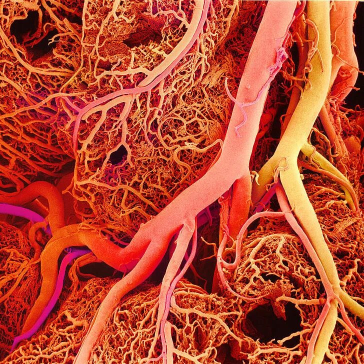 Как выглядят сосуды фото Dyslipidemia Images Free Download on Freepik