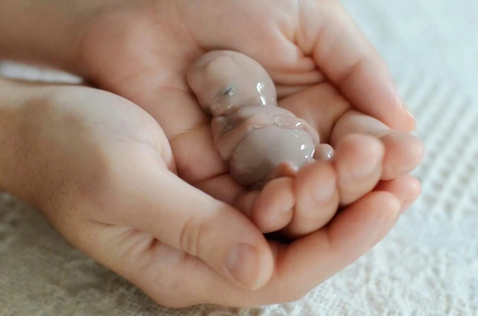 9 дней после рождения. Человеческий зародыш выкидыш. Эмбрион маленький выкидыш.