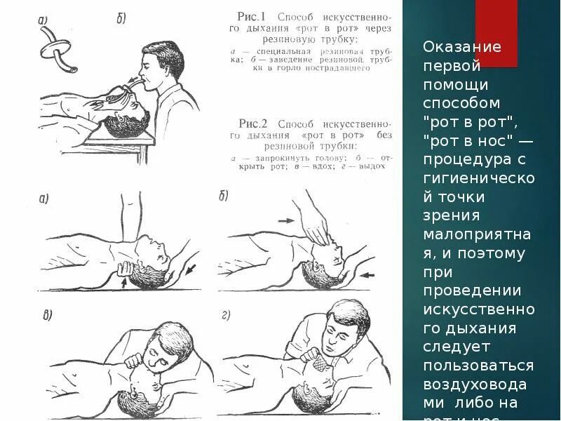 Способы искусственного дыхания. Воздуховод для проведения искусственного дыхания. Искусственное дыхание ошибки.