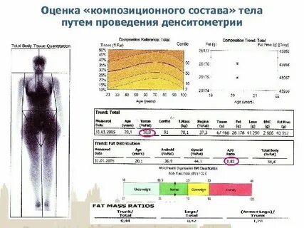Денситометрия по омс в спб