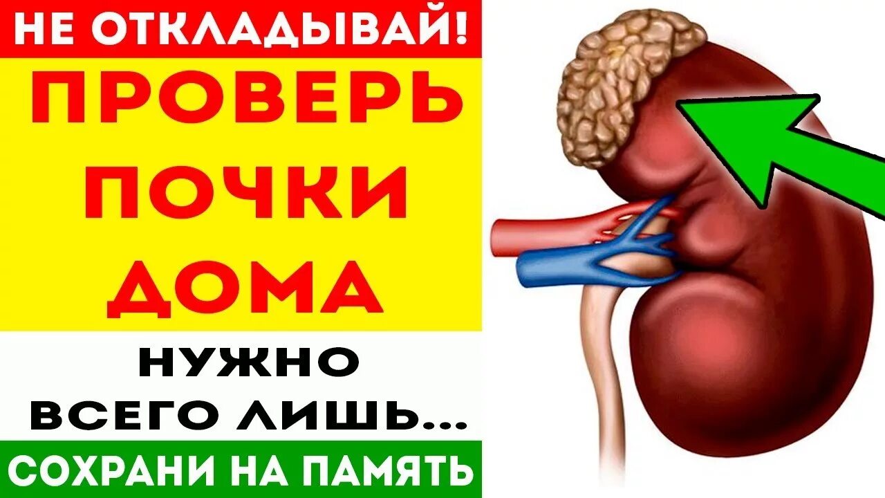 Проверить работу почек. Проверяем почки в домашних условиях. Где можно проверить почки.