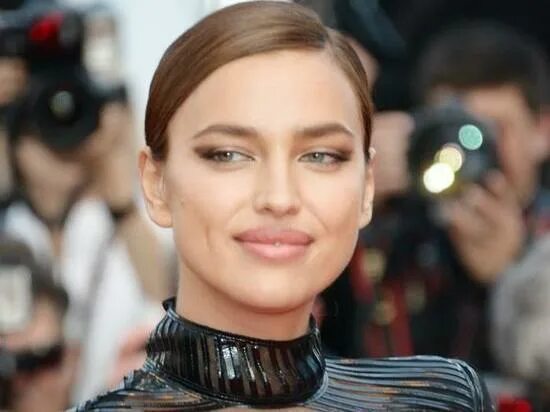 Irina Shayk - Before and After Lip surgery, Irina shayk, Plastic surgery
