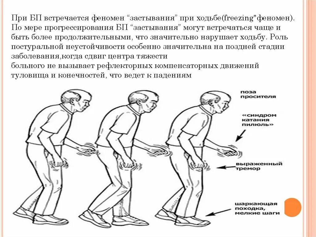 Нарушения при ходьбе. Неустойчивость при ходьбе. Нарушение походки у пожилых. Шаткость в ходьбе. Ведет вправо причины