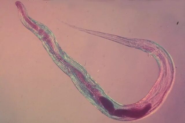 Pin on Enterobius vermicularis