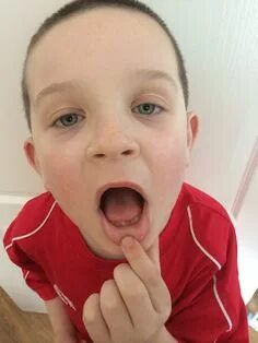 Boy mouth