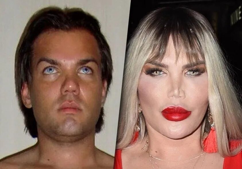 забавные сходства александр лыков. белла хадид ринопластика. разные формы носа. ринопластика. двойник жерара депардье.