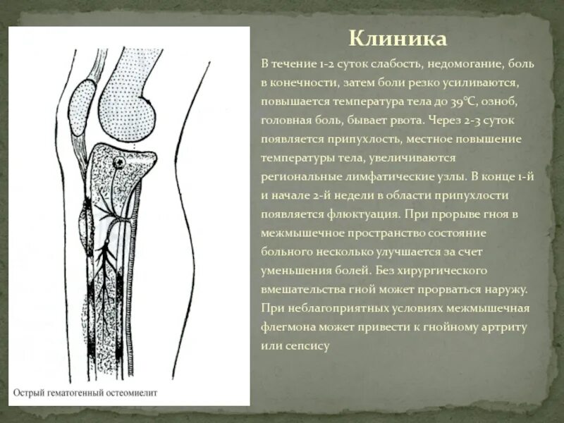 Флегмоны бедра пути распространения. Флегмоны бедра пути распространения. Флегмоны бедра пути распространения. Флегмоны бедра пути распространения. Флегмоны бедра пути распространения.