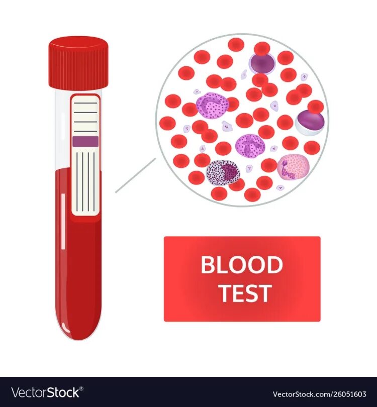 Анализ крови рисунок. Анализ крови векторное изображение. Исследование крови векторный рисунок. Общий анализ крови рисунок.