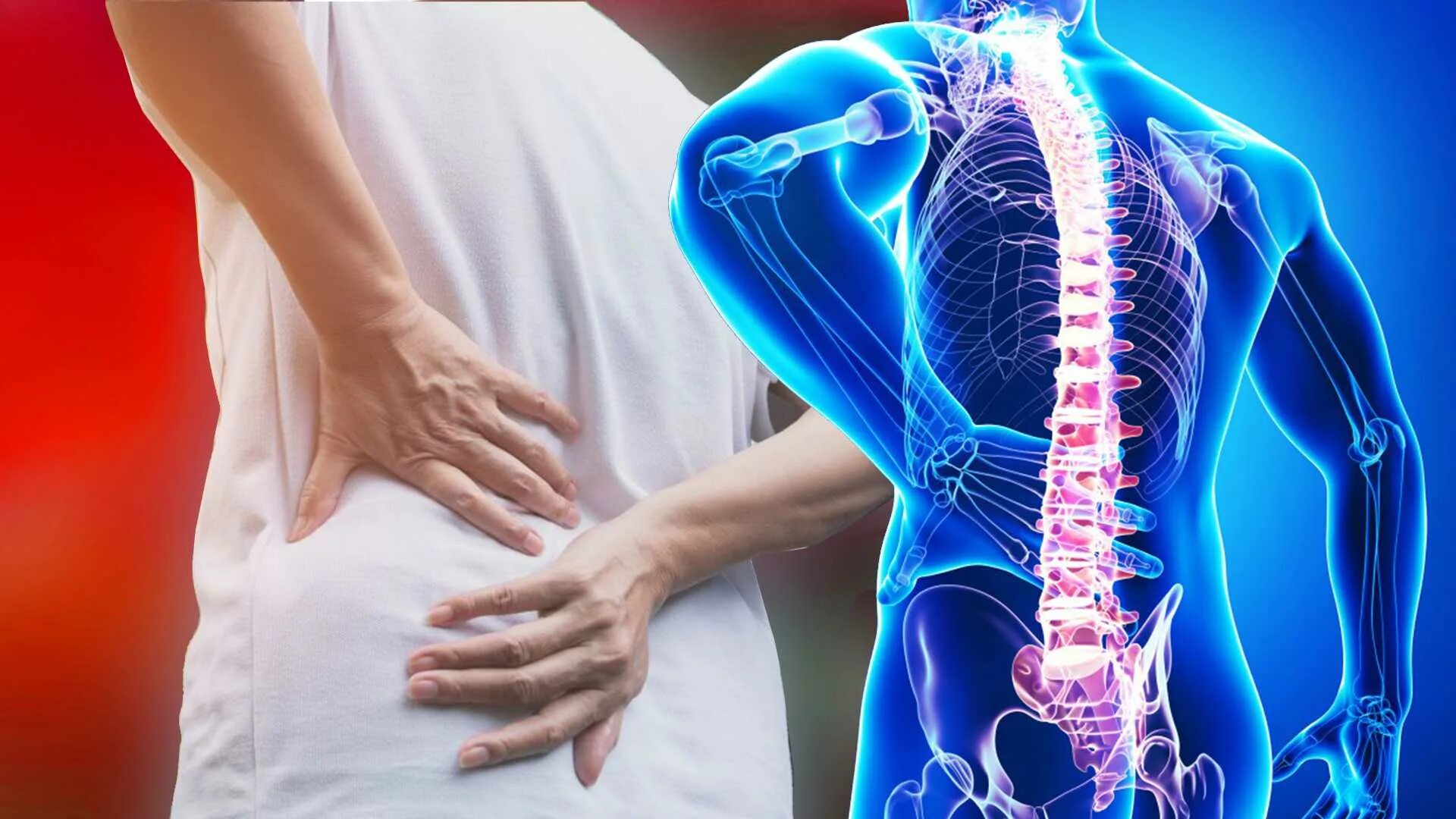 остеохондроз пояснично-крестцового отдела шейного и грудного отдела. остеохондроз поясничного отдела симптомы. остеохондроз крестцового отдела лечение у женщин. остеохондроз поясничного отдела позвоночника симптомы. остеохондроз поясничного отдела позвоночника симптомы.