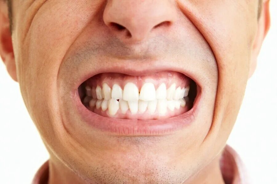 Бруксизм скрипите зубами. Почему сжата челюсть