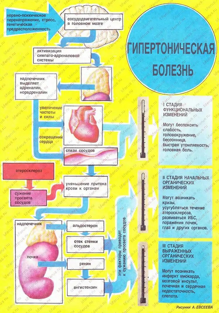 Описание гипертонии. Гипертычеческая болезни. Гипертоническая болезнь. Гипертоническая болезнь больной. Плакаты гипертоническая болезнь сердца.