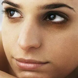 The skin around the eyes