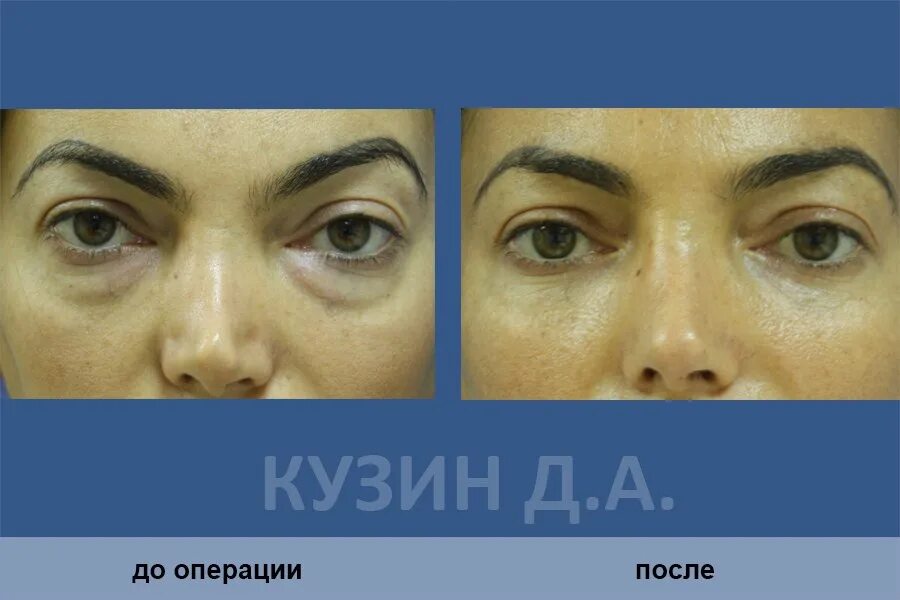 Неизвестную операцию
