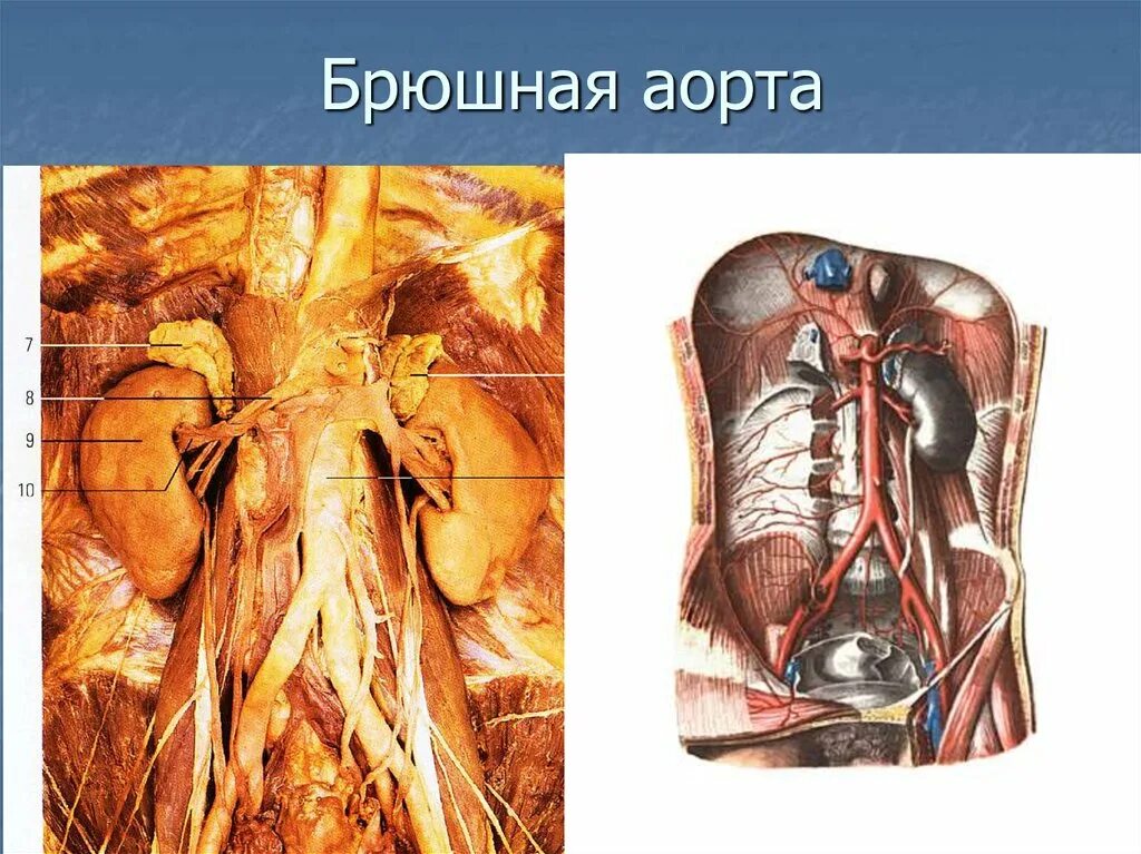 3 брюшная аорта. Синтопия брюшной аорты. анатомия человека брюшная аорта. строение брюшной аорты анатомия. синтопия брюшной части аорты.