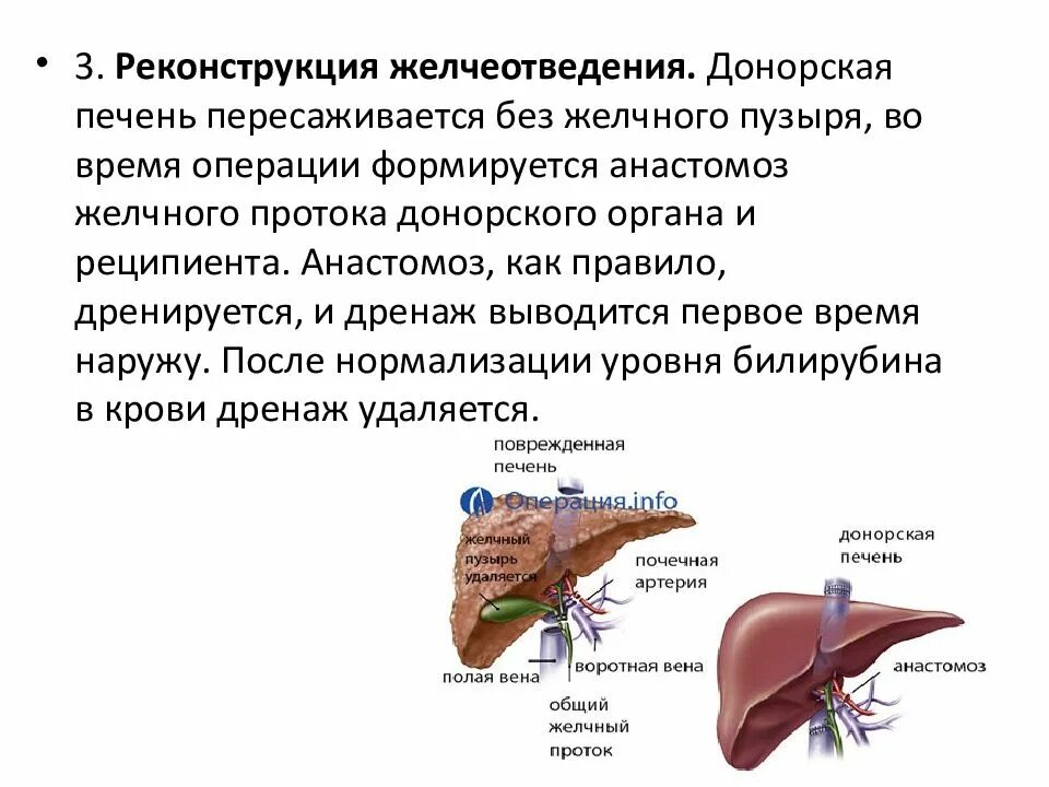 Операция по удалению печени. Трансплантация печени. Печень без желчного пузыря.