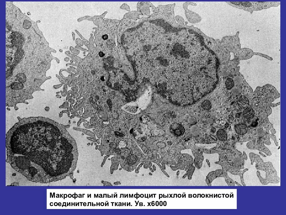 Макрофаг гистология Электронограмма. Макрофаг микрофотография гистология. Фагоцит гистология Электронограмма. Макрофаг гистологический препарат. Свободные макрофаги