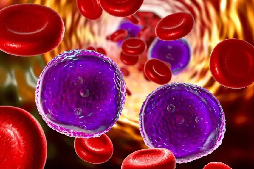 Лейкоз клетки. Лимфоциты. Т клетки крови