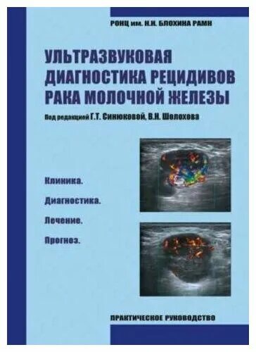 Книги по УЗИ диагностике молочных железах. Книги по УЗИ диагностике молочной железы. Книга УЗИ диагностика молочной железы Заболотская. Ультразвуковая диагностика молочных желез литература. Ультразвуковая диагностика книги