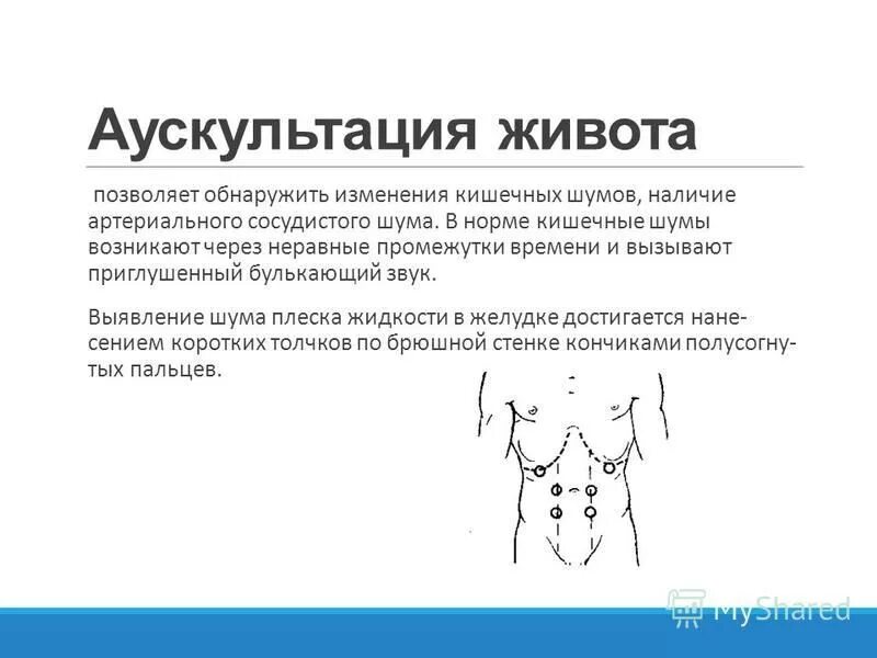 Пальпация при остром животе. Точки аускультации живота схема. Аускультация живота пропедевтика внутренних болезней. Технология аускультации живота. Аускультация кишечника алгоритм.