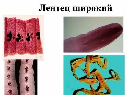Широкий лентец под микроскопом