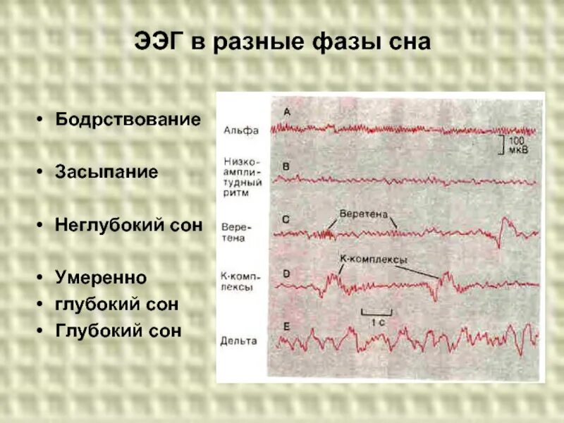 Ээг бодрствования. Фазы сна на ЭЭГ. ЭЭГ В разные фазы сна. Стадии сна по данным ЭЭГ. ЭЭГ критерии фаз сна.