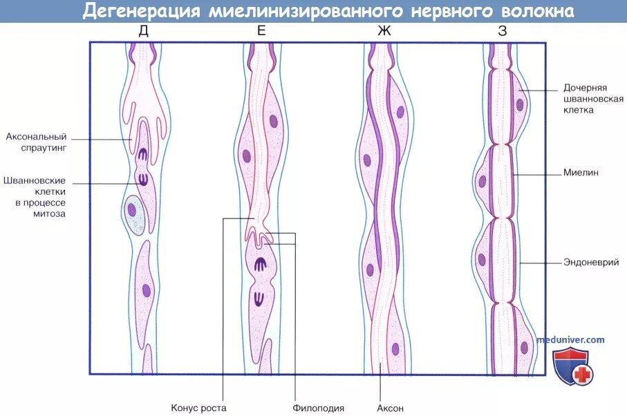 Регенерация нервных волокон. Дегенерация и регенерация нервных волокон. Дегенерация и регенерация периферического нерва. Регенерация периферических нервов.