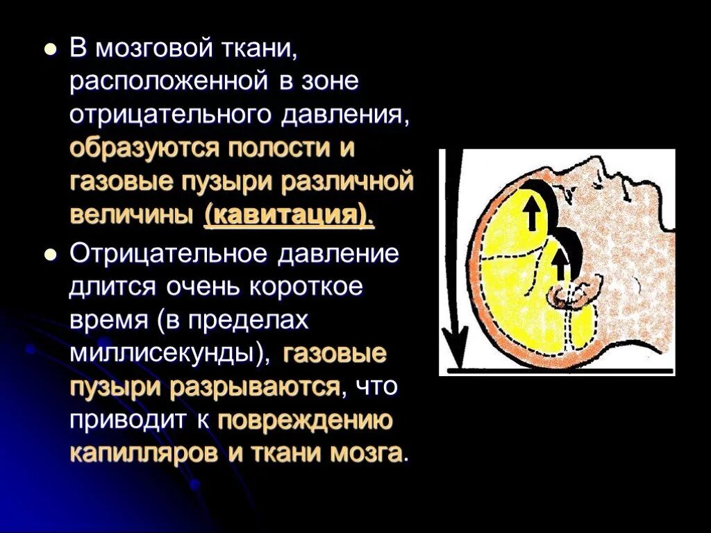 Повышенное давление головного мозга. Черепно мозговое давление. отрицательное давление. мозговая ткань повреждение. черепное давление лекция.