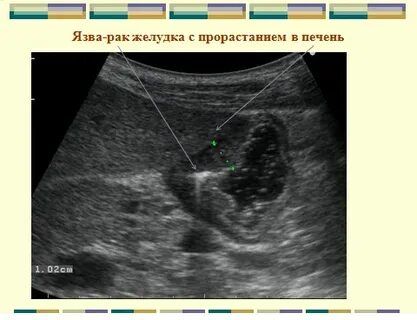 Узи полых