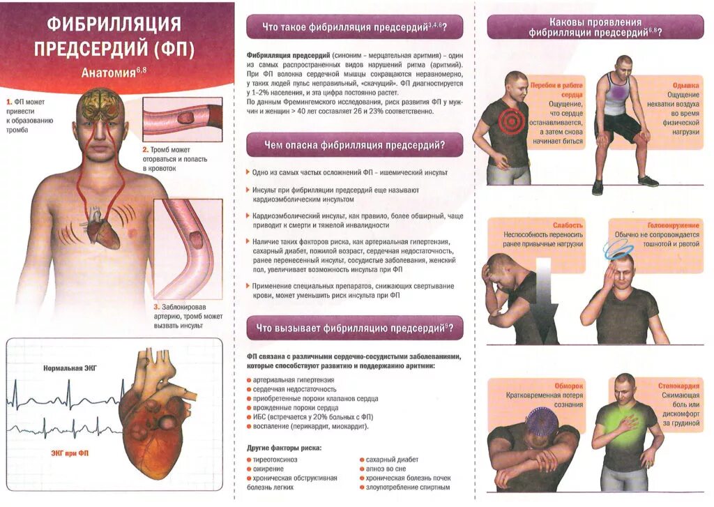 Аритмия и гипертония. Памятка для больных с нарушениями ритма сердца. Профилактика аритмии сердца. Аритмия буклет. Аритмия памятка.