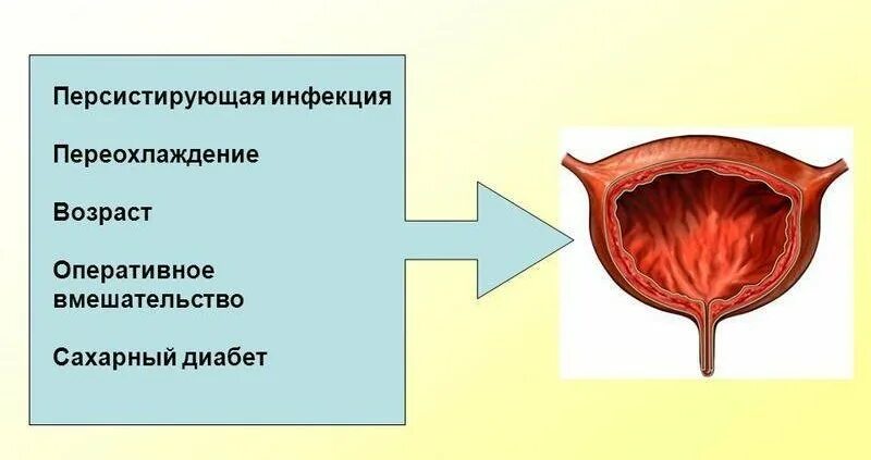 Симптомы острого цистита у женщин. Воспалительные заболевания мочевого пузыря. Инфекционное воспаление мочевого пузыря. Острый и хронический цистит.