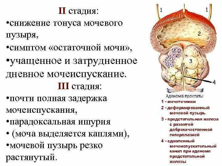 Задняя поверхность мочевого пузыря у мужчин прилежит. Гипертонус мочевого пузыря. Симптомы мочевого пузыря. Мышечный тонус мочевого пузыря. Тонус мочевого пузыря повышают.