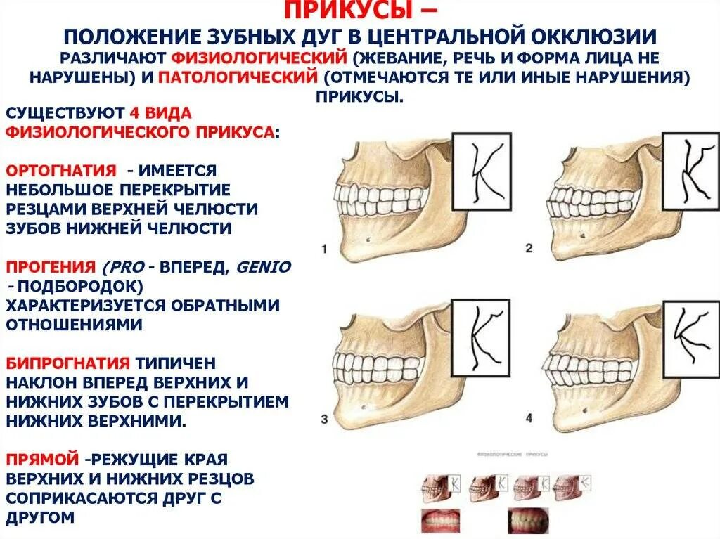 Почему зубы отличаются между собой у разных. Правильный прикус у человека схема сбоку. Физиологические и патологические виды прикуса. Правильный прикус вид сбоку у ребенка. Ортогнатический прикус сбоку.
