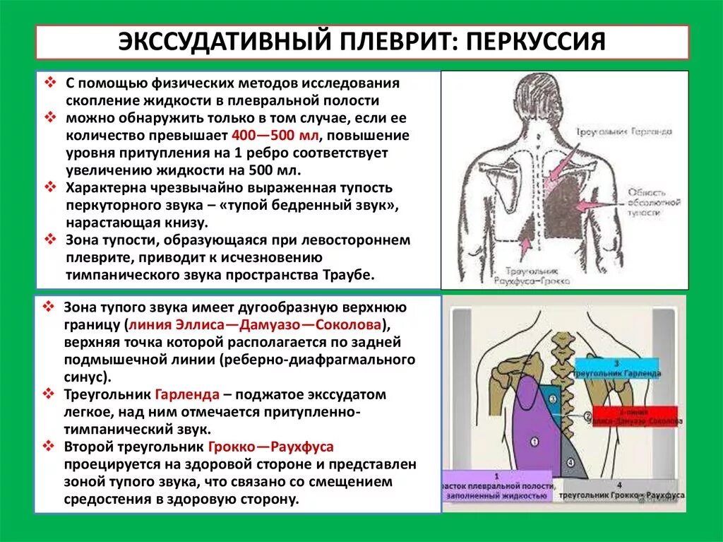 Данные перкуссии при экссудативном плеврите. Перкуторные данные при экссудативном плеврите.. Гидроторакс перкуссии при аускультации. Аускультативно при экссудативном плеврите. Полость заболевания легких