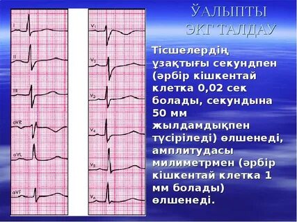 Клетка экг