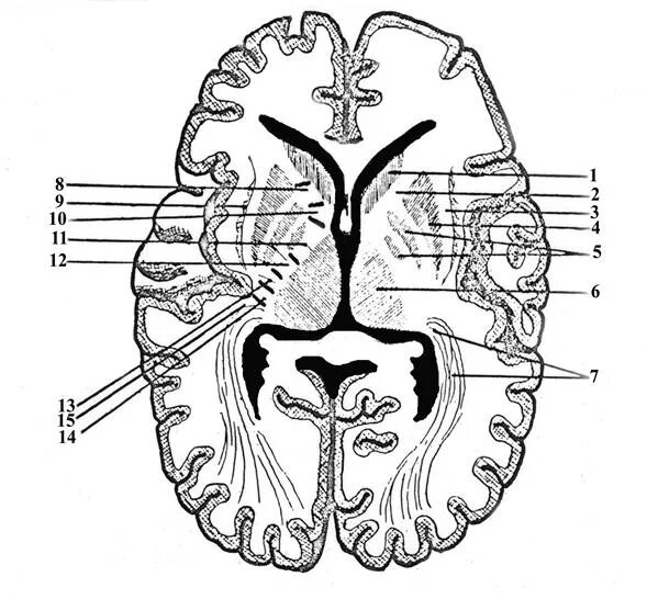 Горизонтальный срез мозга базальные ядра. Базальные ядра внутренняя капсула. Горизонтальный разрез головного мозга базальные ядра. Подкорковые ядра и белое вещество полушарий.