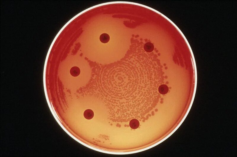 Бактерии устойчивые к антибиотикам. Чашка Петри антибиотикорезистентность. Устойчивость бактерий к антибиотикам. Антибиотикочувствительность микроорганизмов. Резистентность микроорганизмов к антибиотикам биотехнология.