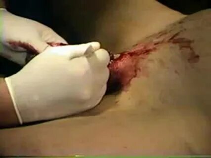 Next page. жировички 4К. 