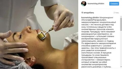 Микроигольчатая мезотерапия