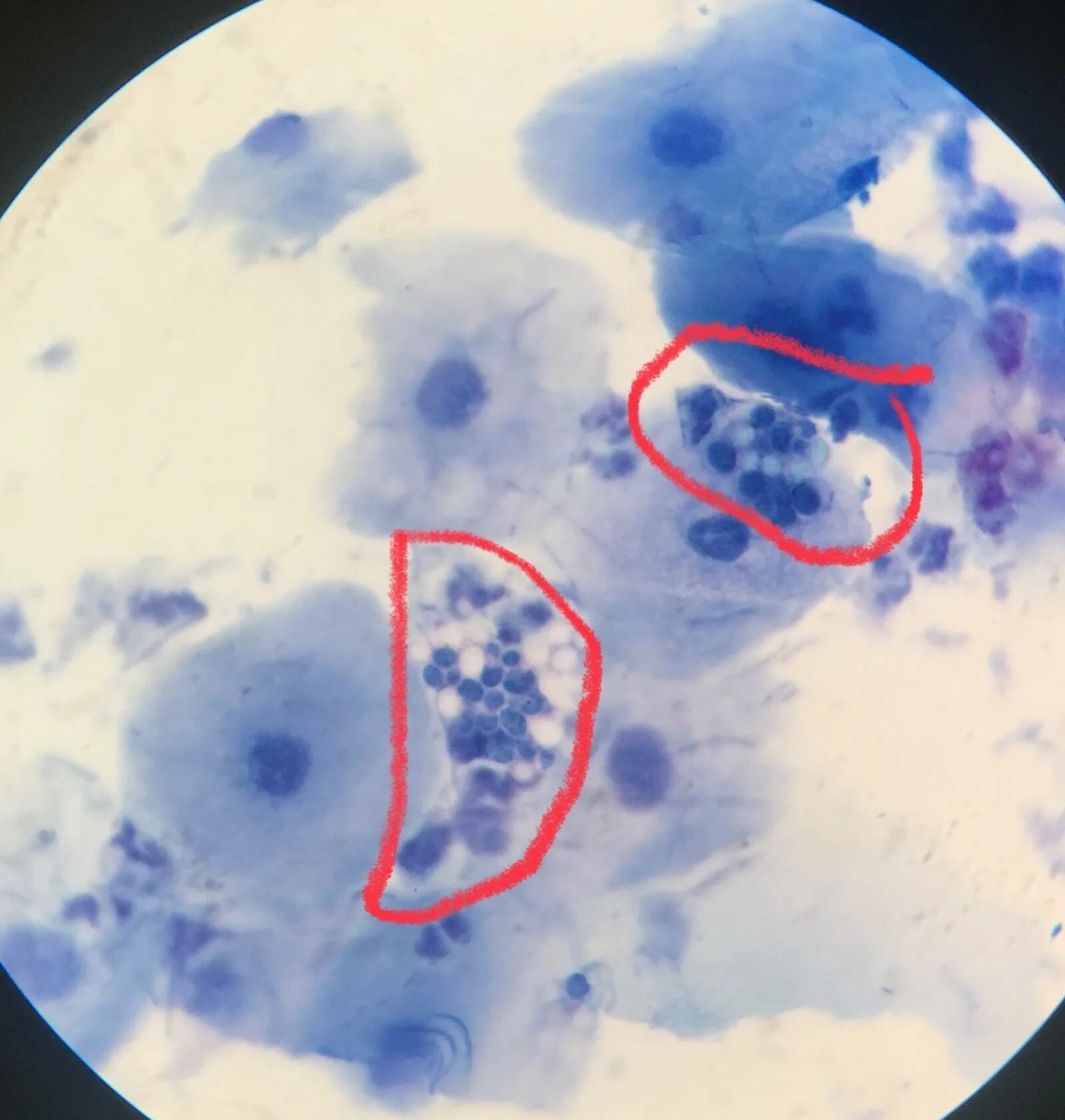 исследование соскоб с языка. соскоб с языка анализ. соскоб с языка на кандида альбиканс. кандида микроскопия. соскоб с языка на кандиды.
