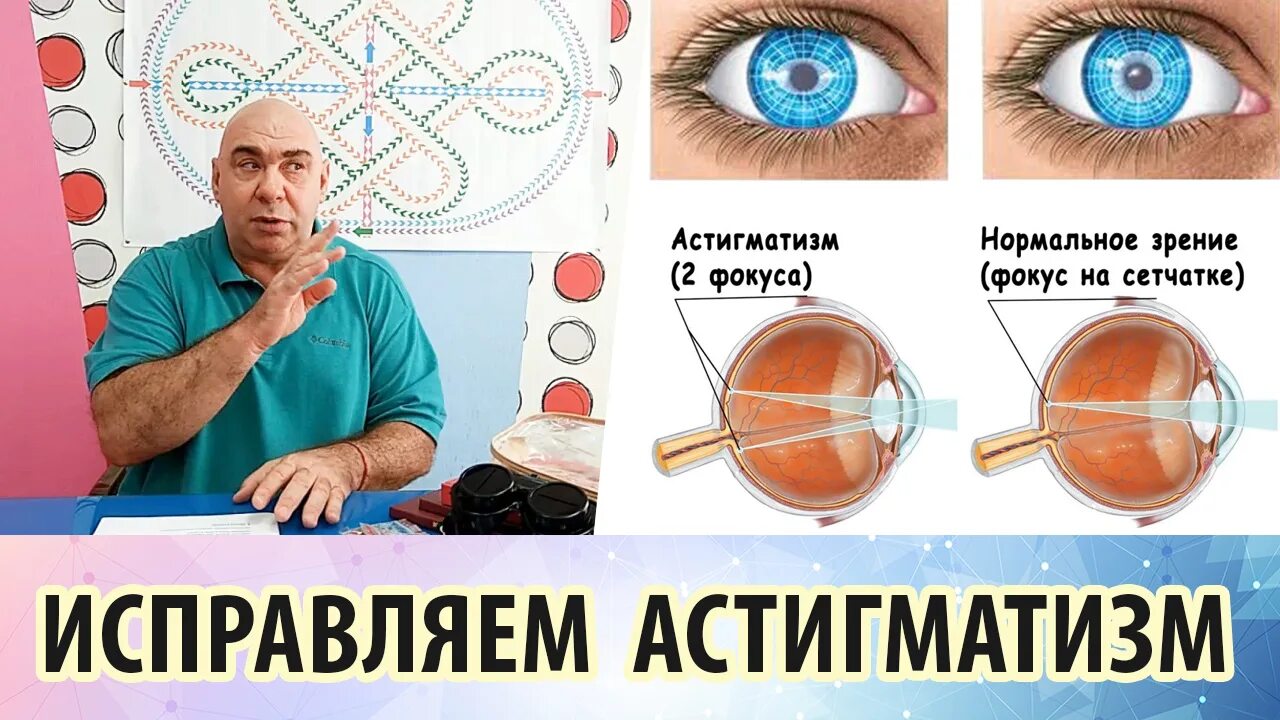 Упражнения для зрения астигматизм. Упражнения для глаз от астигматизма. Упражнения для миопии и астигматизма. Упражнения для восстановления зрения при астигматизме. Полная восстановления зрения